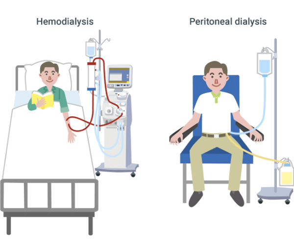 Dialysis Services in Nagpur