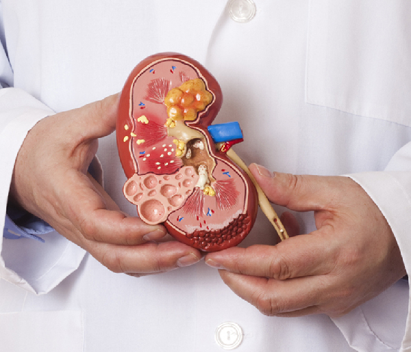 Post-Kidney Transplant Care in Ayodhya Nagar, Nagpur