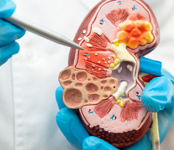 Kidney Biopsy & Evaluation in Nagpur